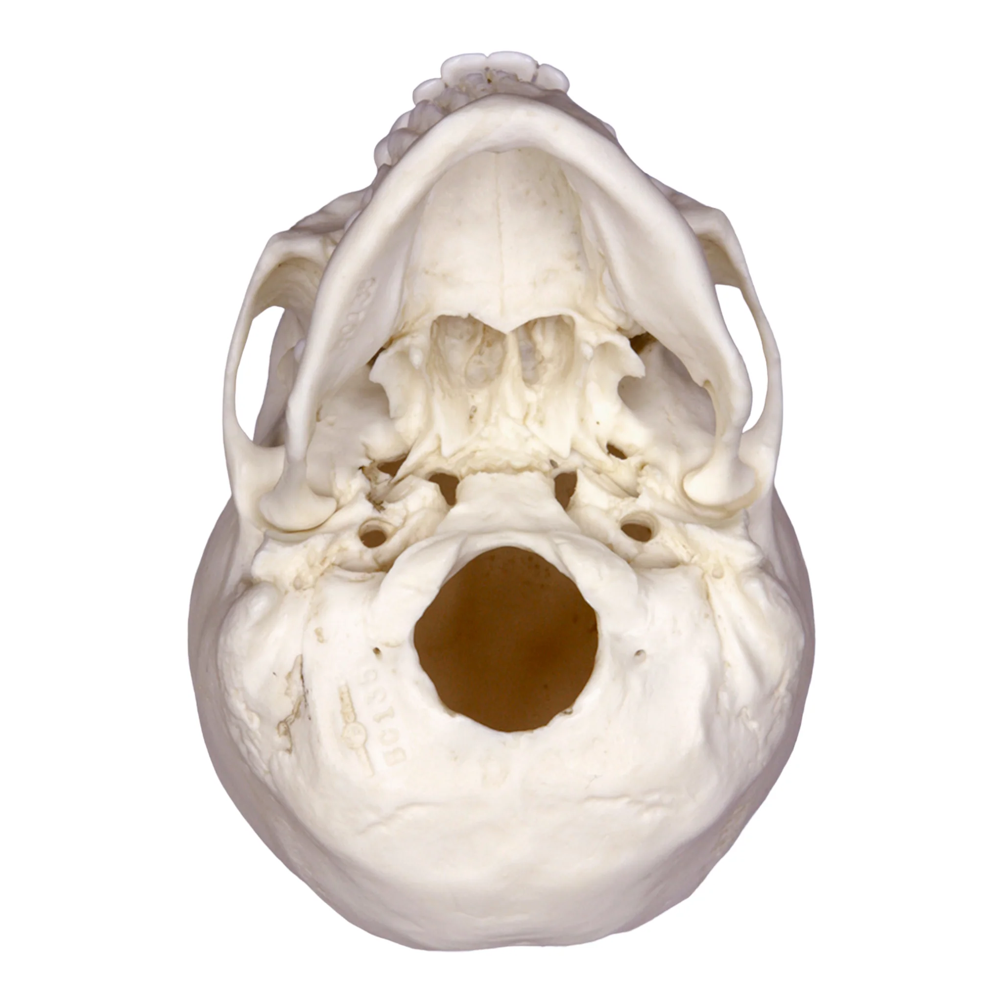 Replica 12-year-old Human Child with Dentition Exposed - Image 6