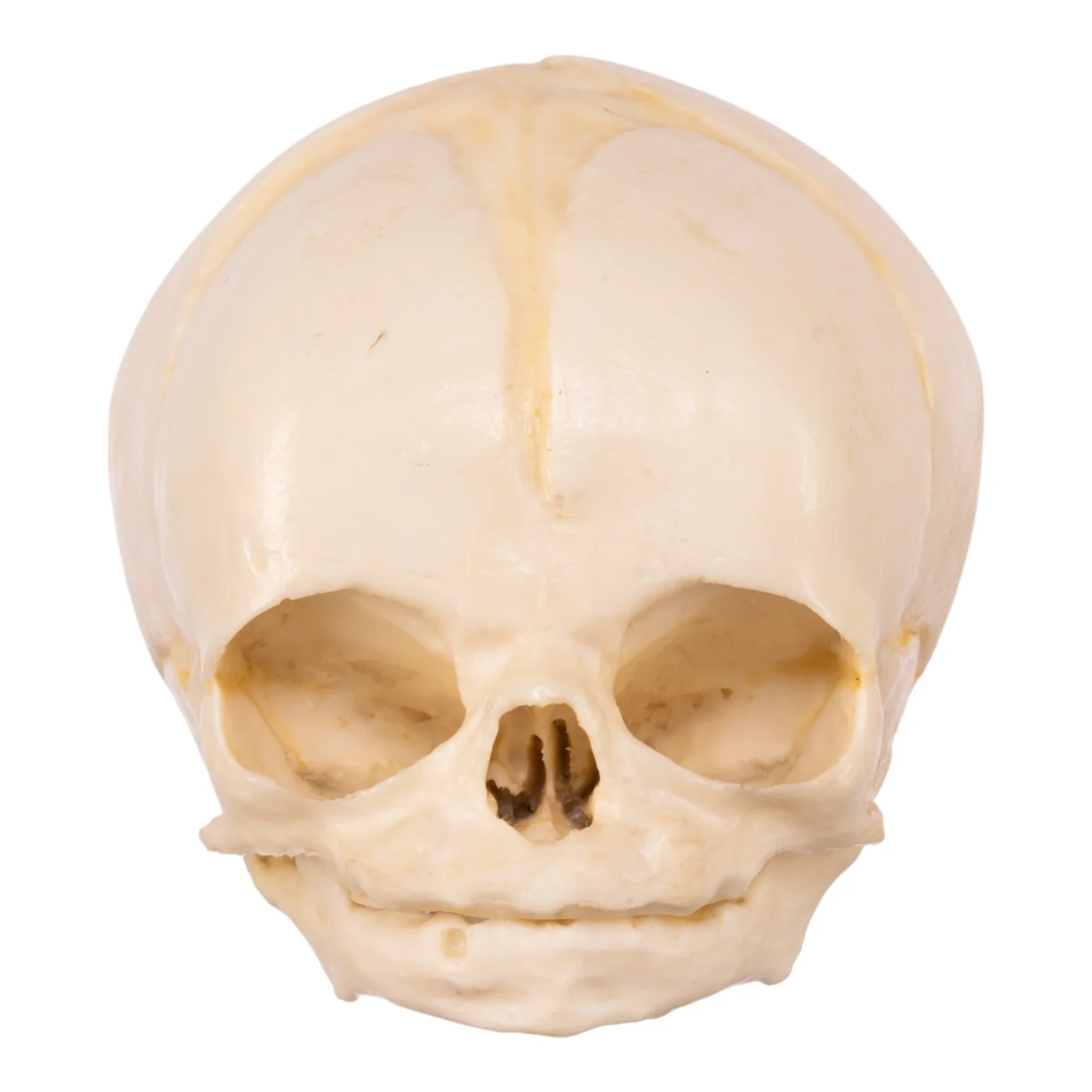 Replica Human Fetal Skull - 32 Weeks - Image 3