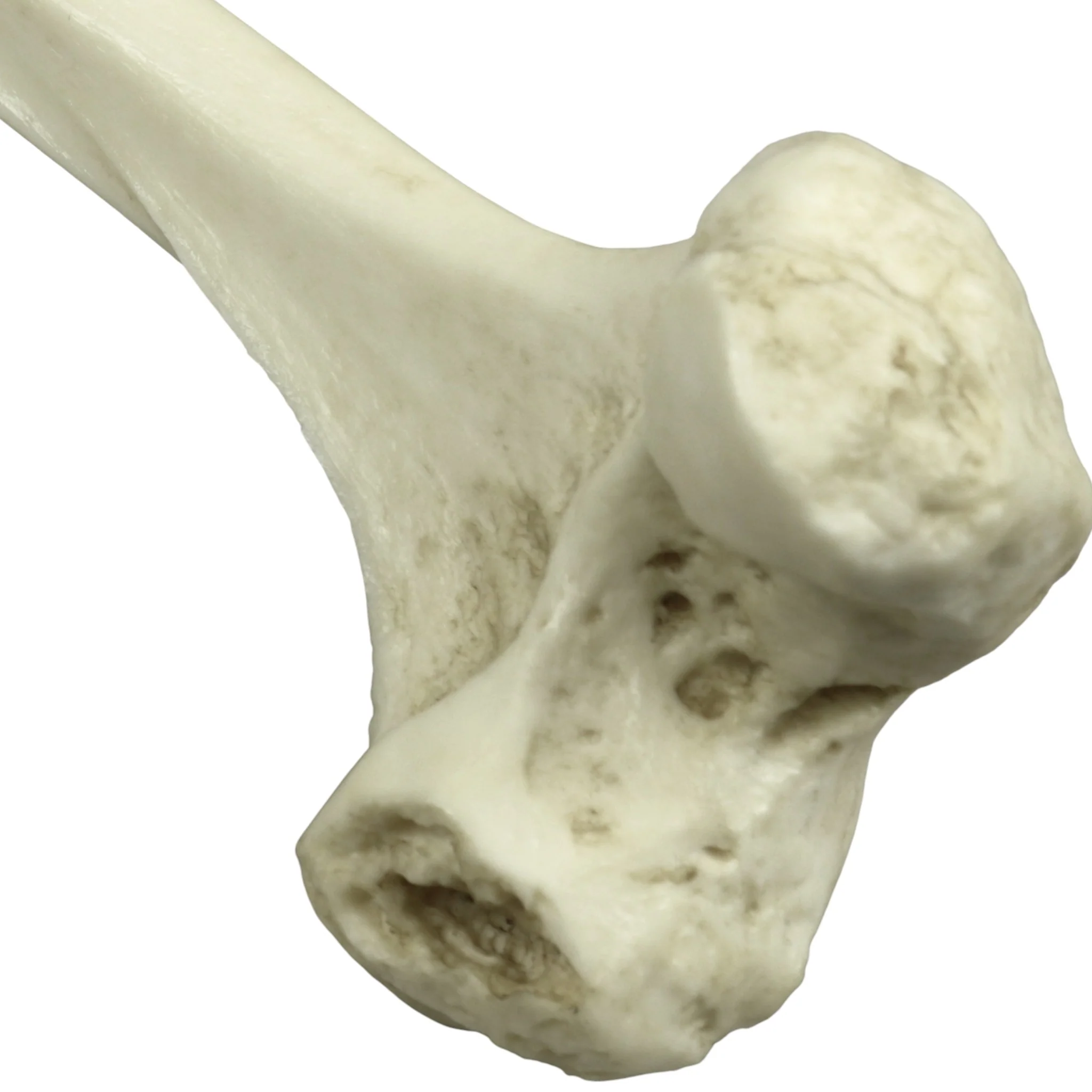 Replica Human Left Femur with Polio - Image 7