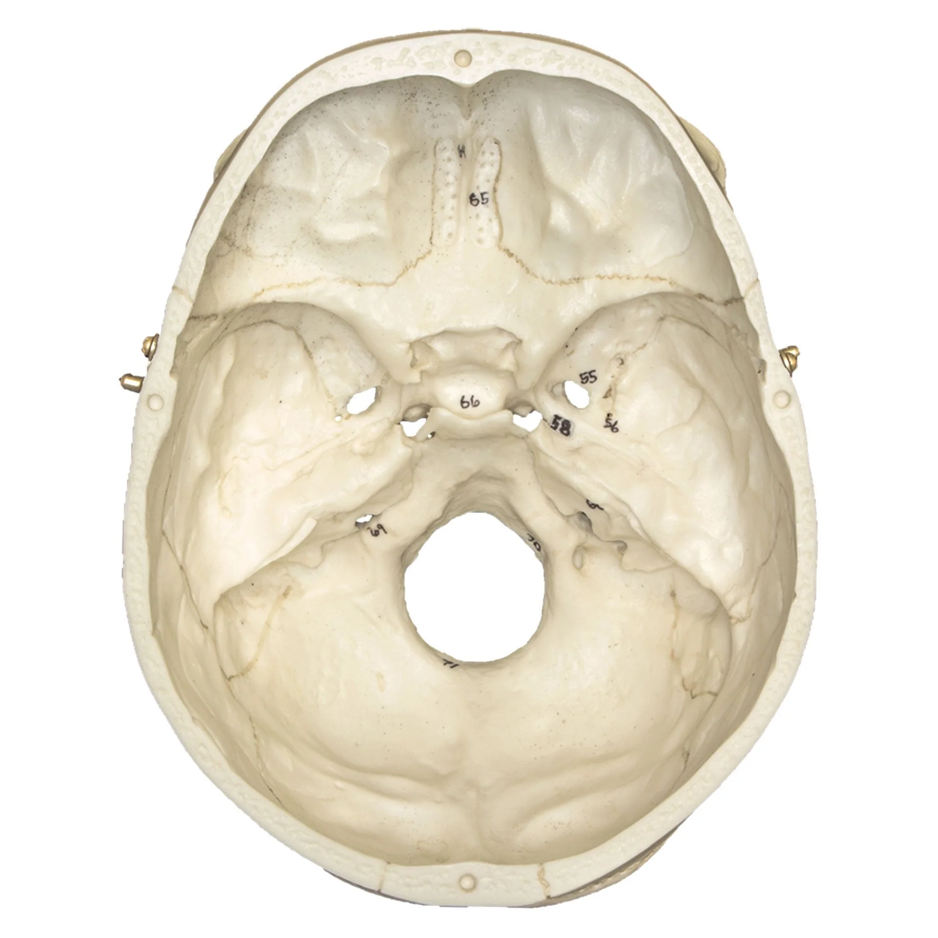 Replica Human European Male Skull - Calvarium Cut and Numbered - Image 6
