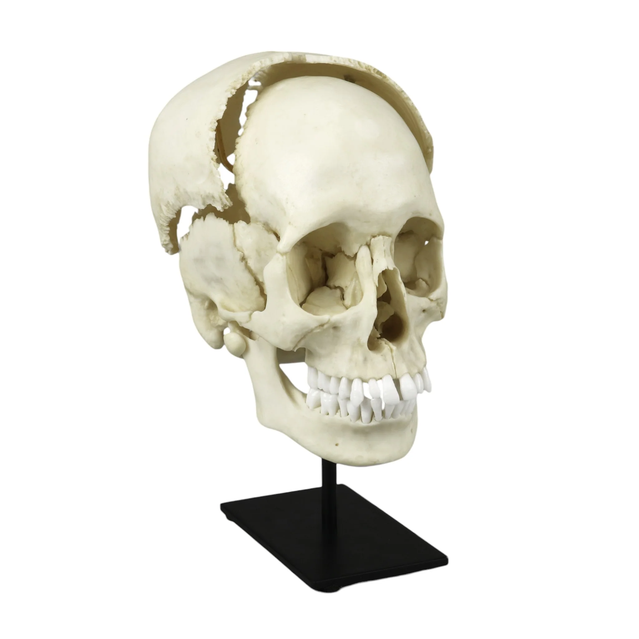 Replica Human Medical Study Skull - Articulated - Image 2
