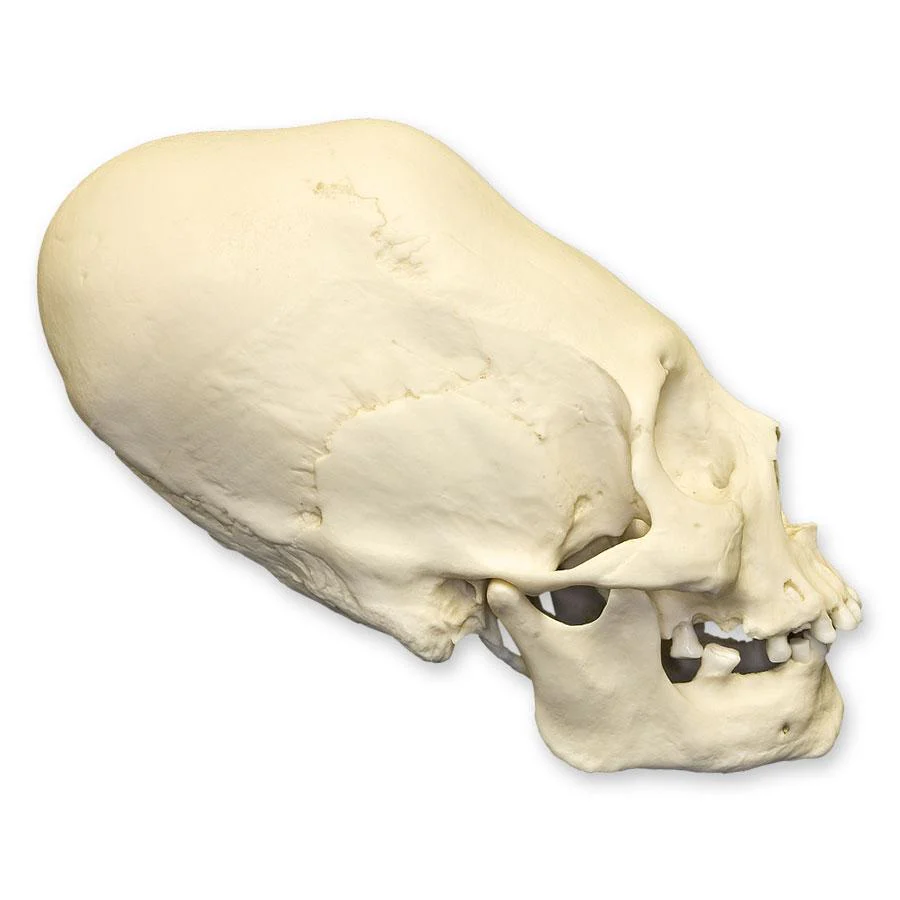 Replica Human Peruvian Female Skull with Cranial Binding - Image 2