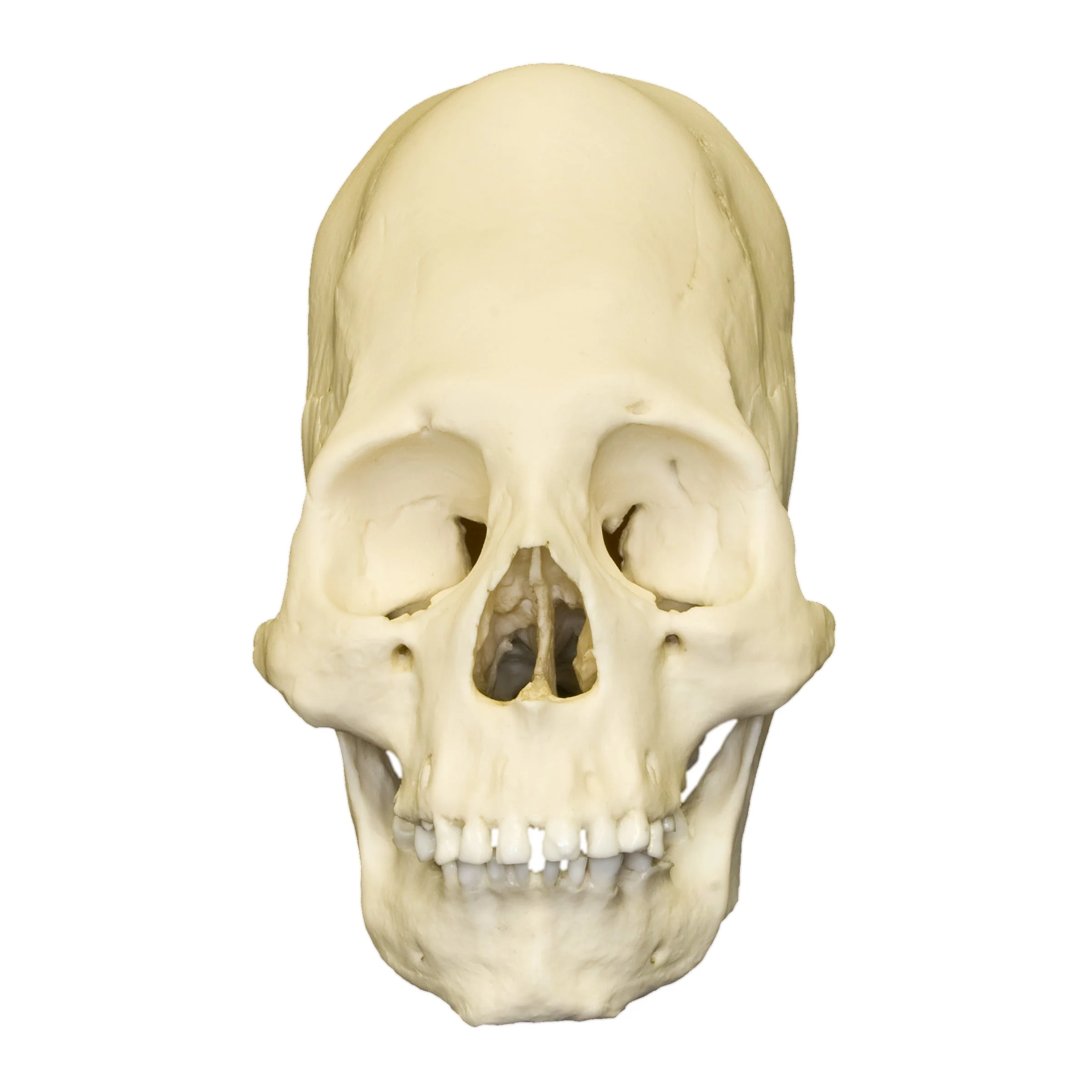 Replica Human Peruvian Female Skull with Cranial Binding - Image 3