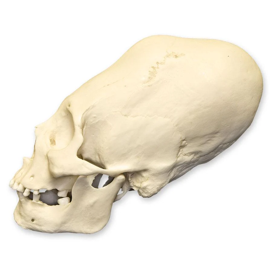 Replica Human Peruvian Female Skull with Cranial Binding - Image 4
