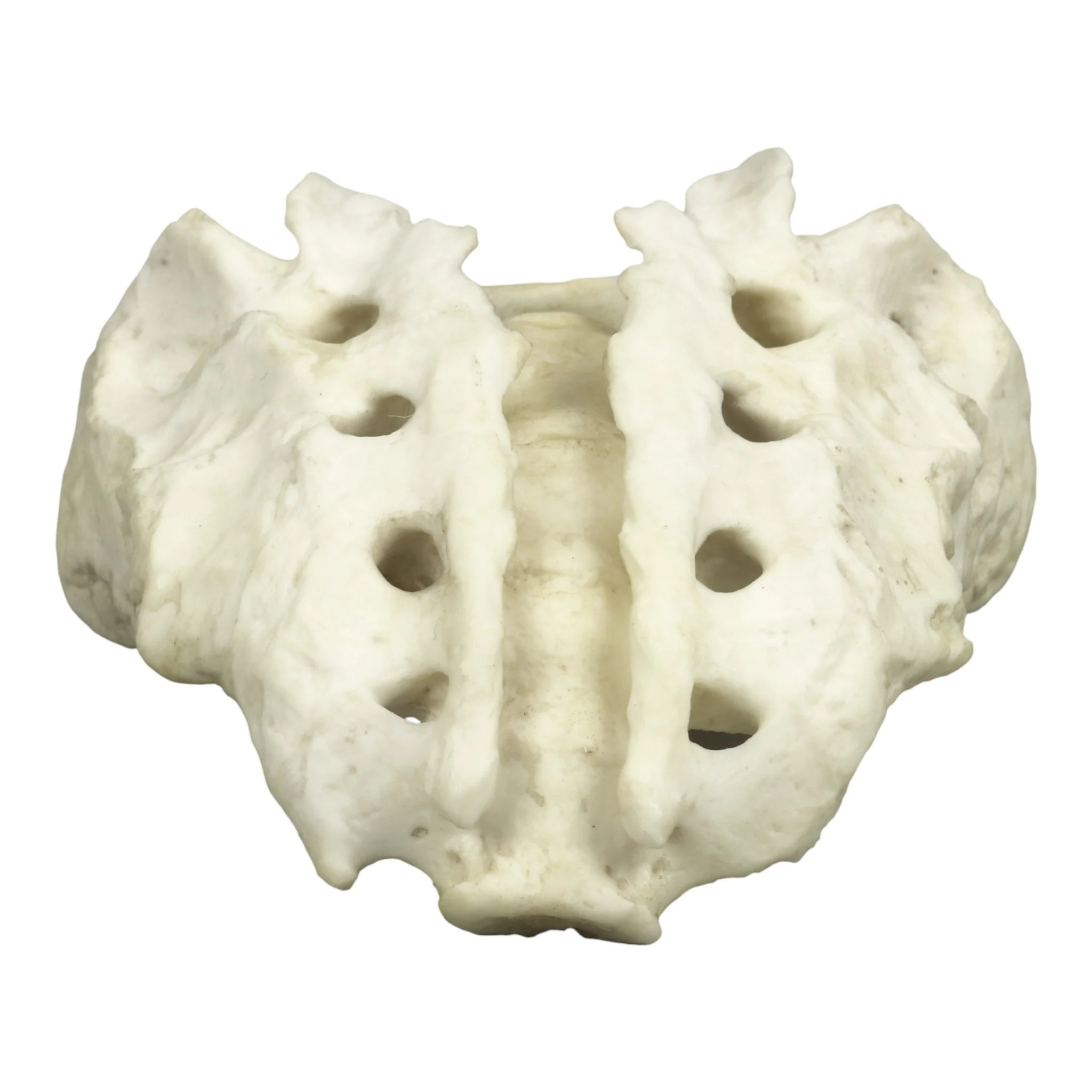 Replica Human Sacrum with Spina Bifida - Image 6
