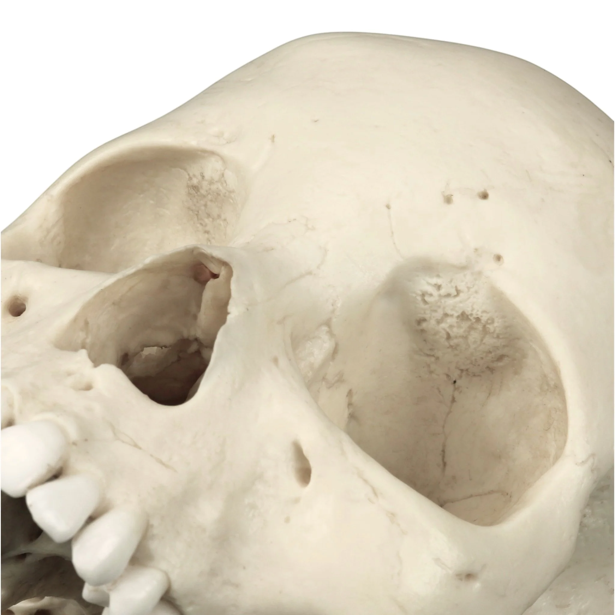 Replica Human Skull - Porotic Hyperostosis and Cribra Orbitalia - Image 12