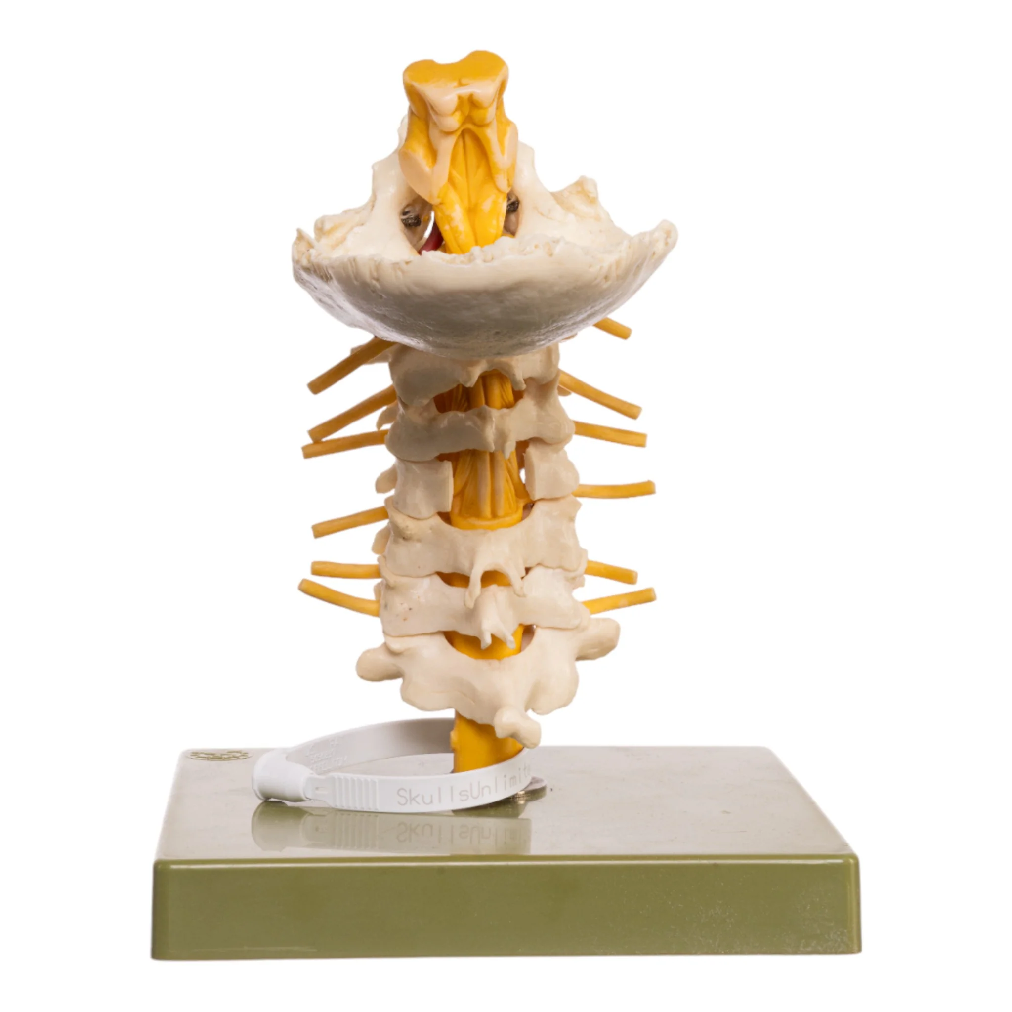 Replica Human Occipital and Neck Model - Image 5