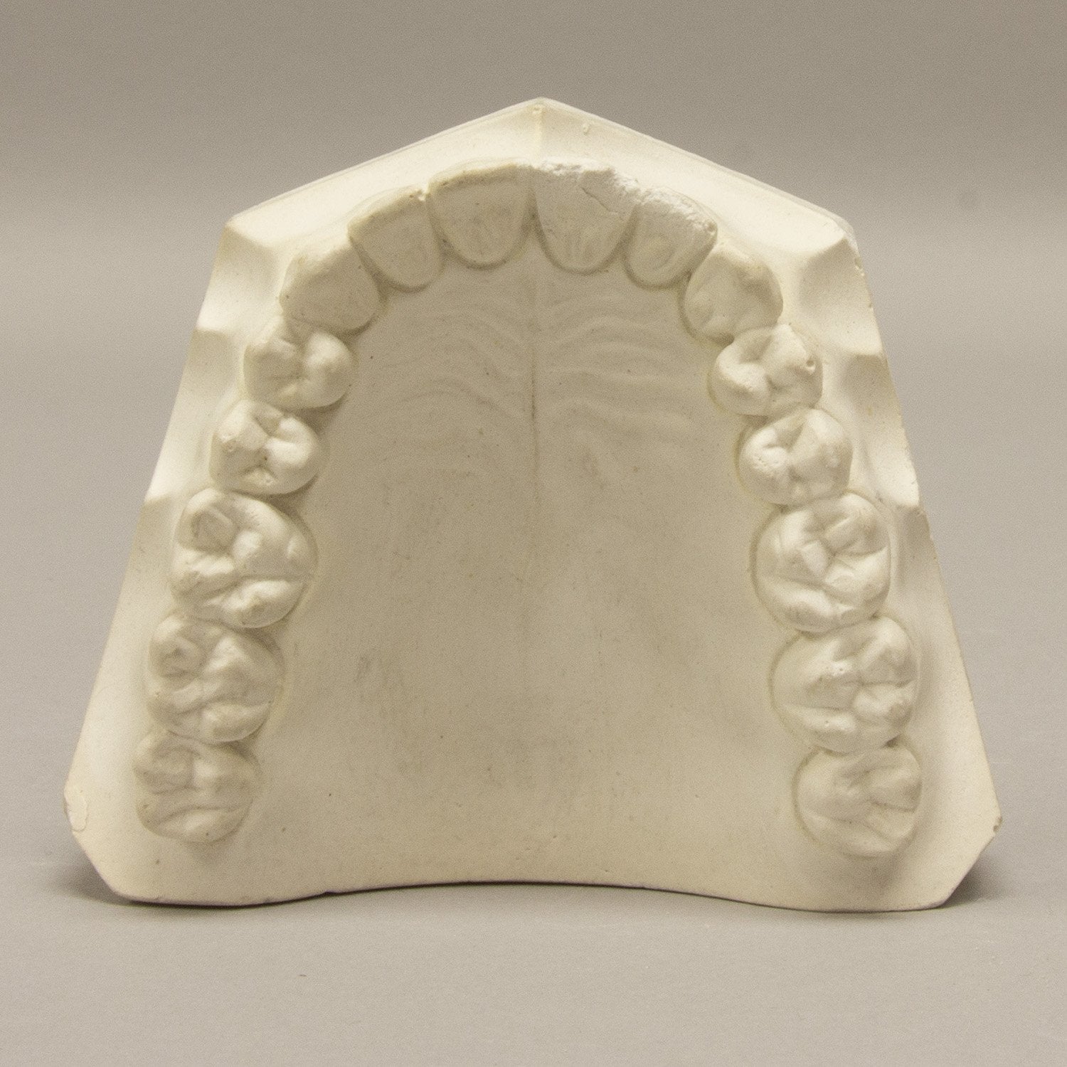 Replica Orthodontic Study Model - Image 3