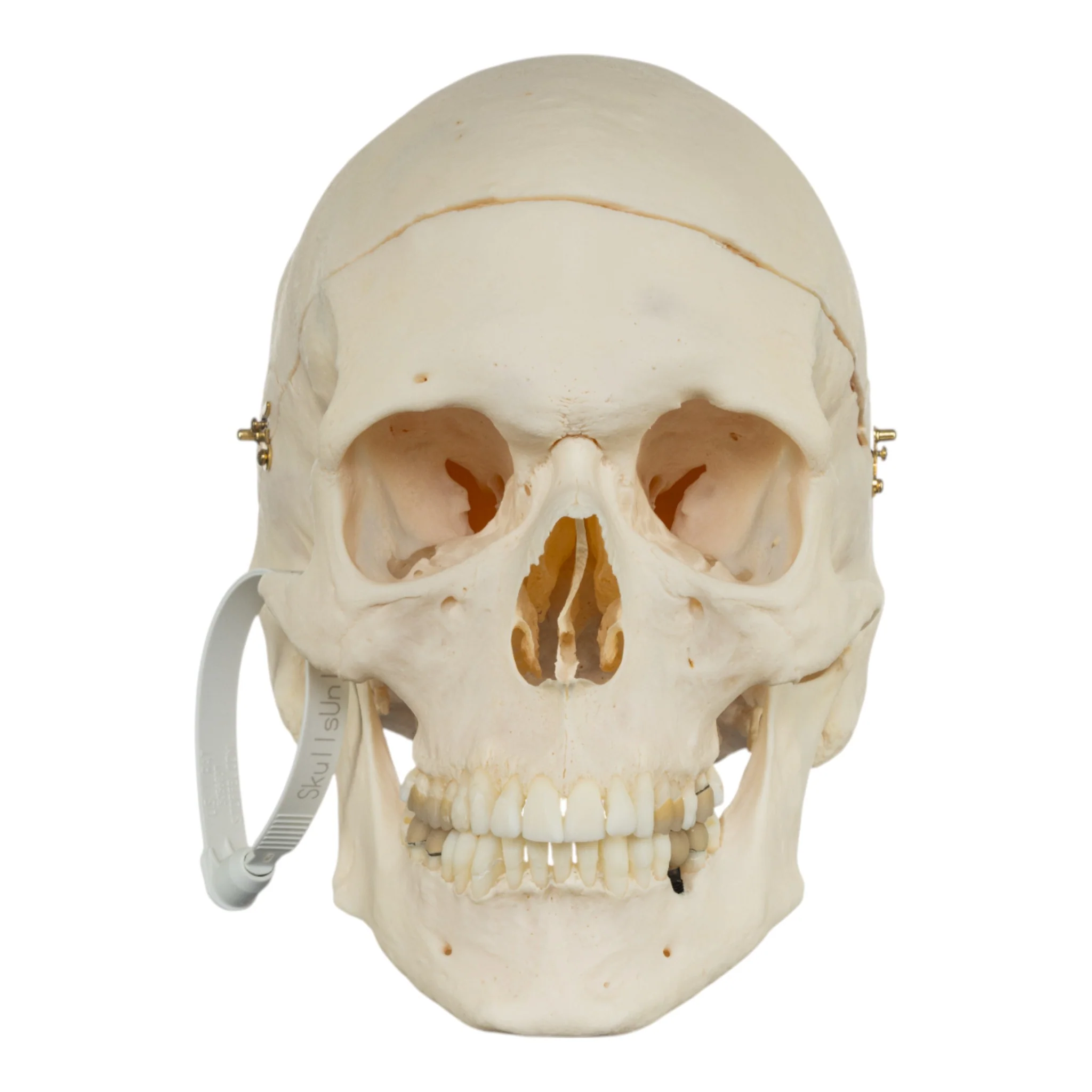Real Research Quality Human Skull - Pathology - Image 3