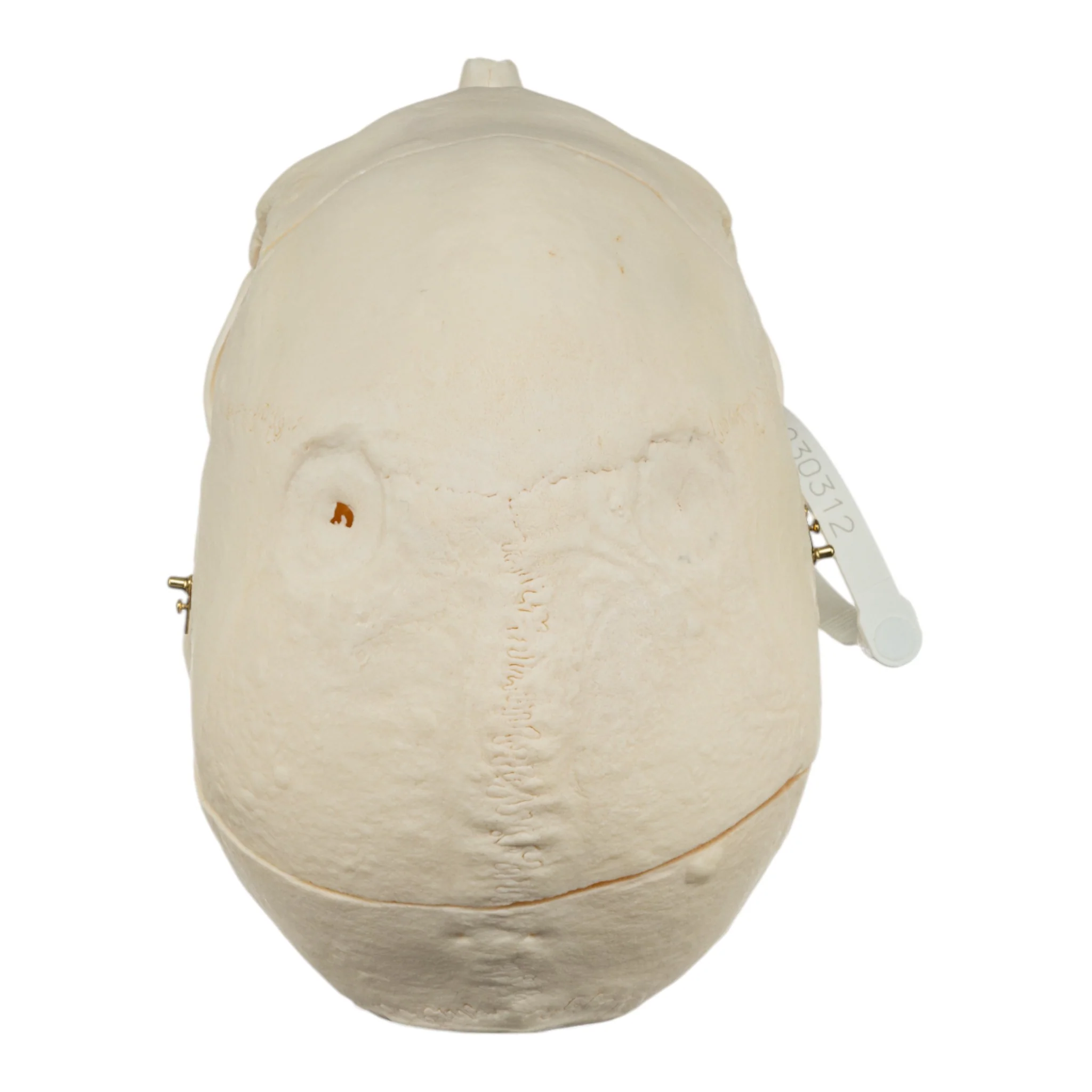 Real Research Quality Human Skull - Pathology - Image 7
