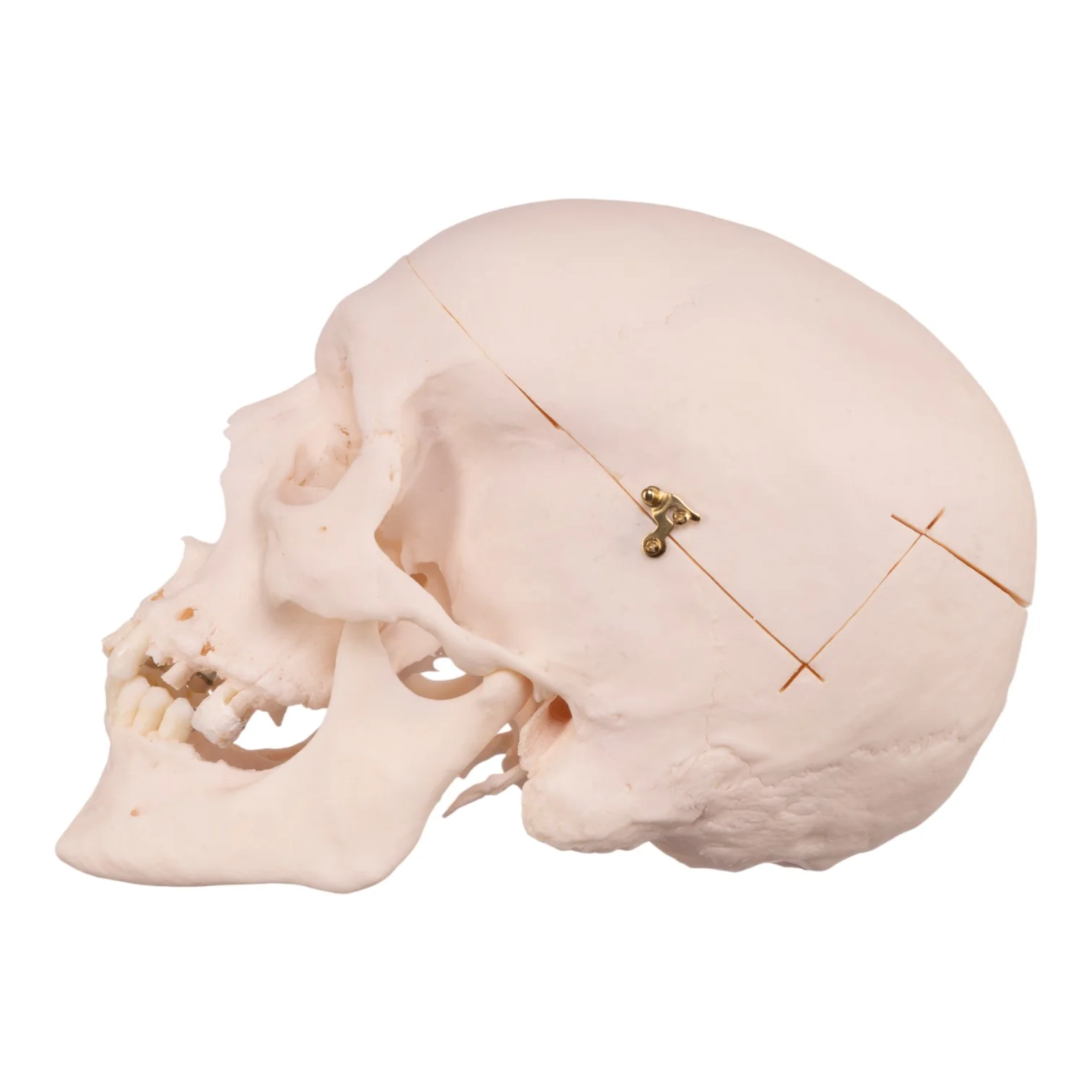 Real Research Quality Human Skull - Image 4