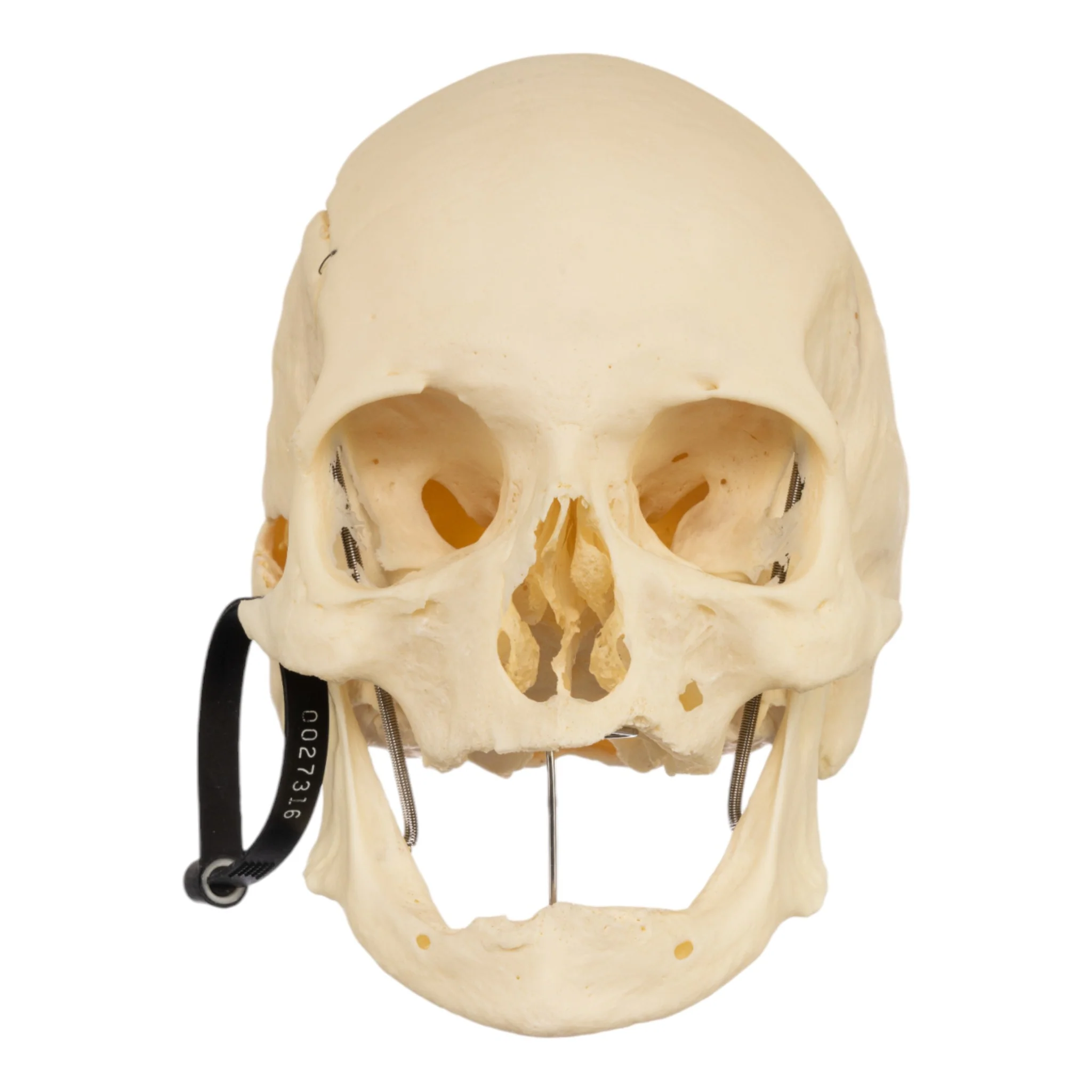 Real Research Quality Human Skeleton - Disarticulated (Pathology) - Image 4