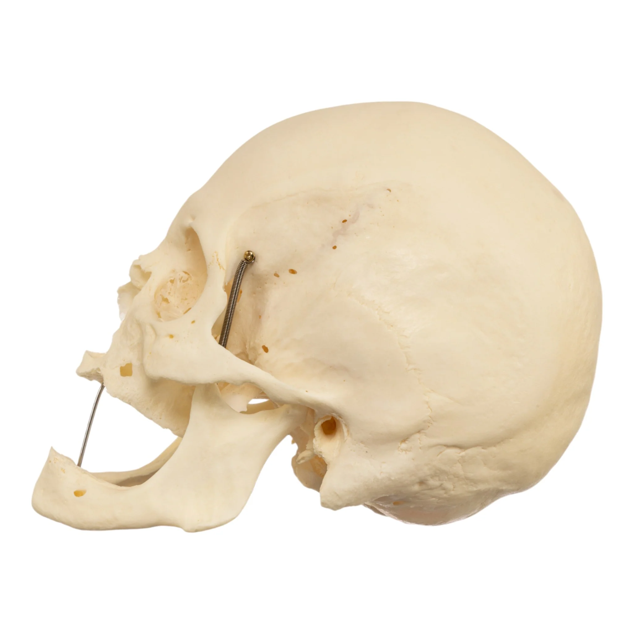 Real Research Quality Human Skeleton - Disarticulated (Pathology) - Image 5