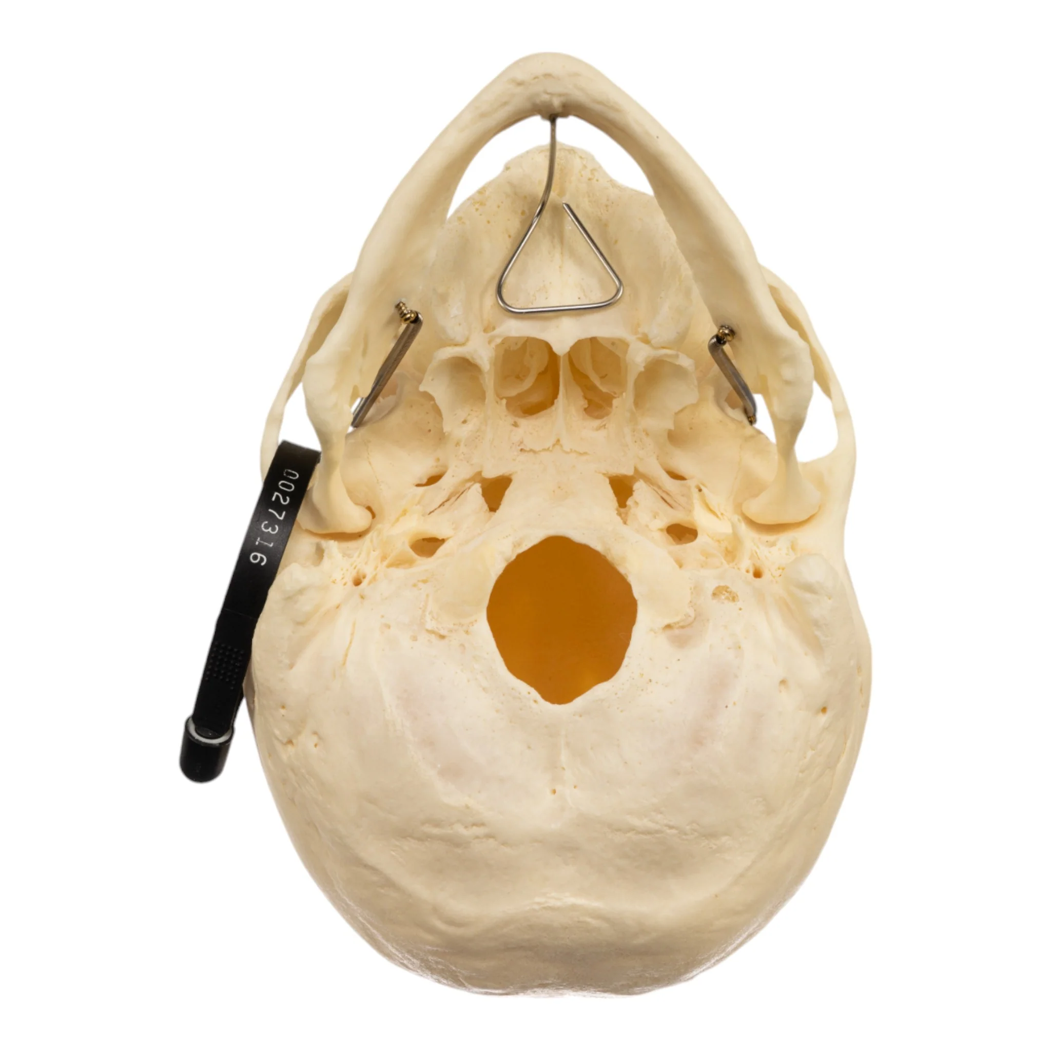 Real Research Quality Human Skeleton - Disarticulated (Pathology) - Image 7