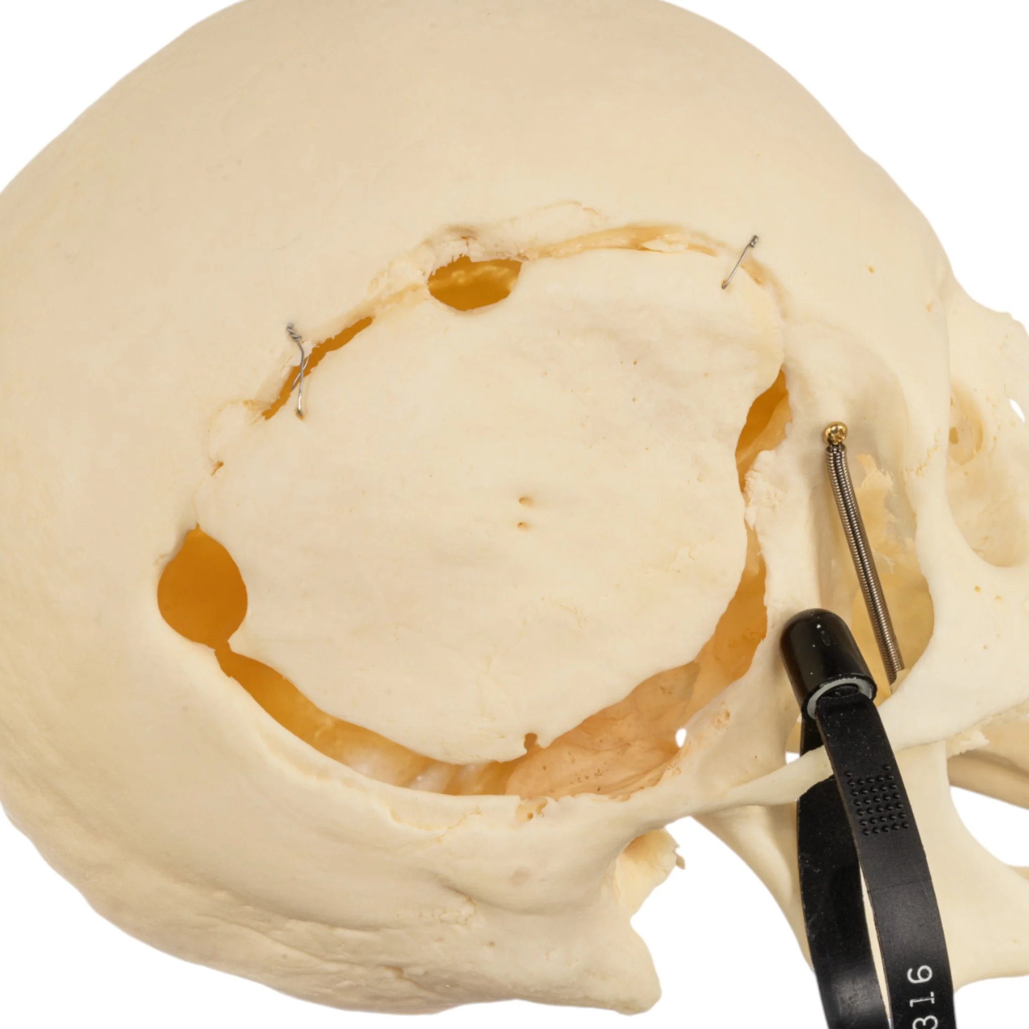 Real Research Quality Human Skeleton - Disarticulated (Pathology) - Image 8
